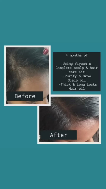 Healthy Scalp & Hair Trio