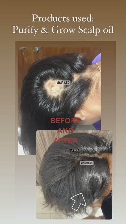 Healthy Scalp & Hair Trio